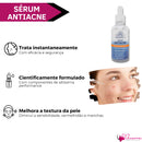 Tratamento Facial Completo Antiacne Phallebeauty Kit 4 Un