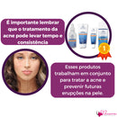 Tratamento Facial Completo Antiacne Phallebeauty Kit 4 Un