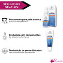 Kit Antiacne Completo Pele Saudável Livre Espinhas 8 Itens