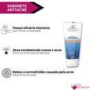 Kit Antiacne Completo Pele Saudável Livre Espinhas 8 Itens